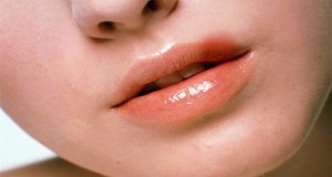 Traditional methods of herpes treatment