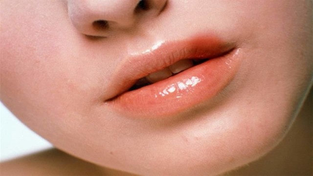 Traditional methods of herpes treatment