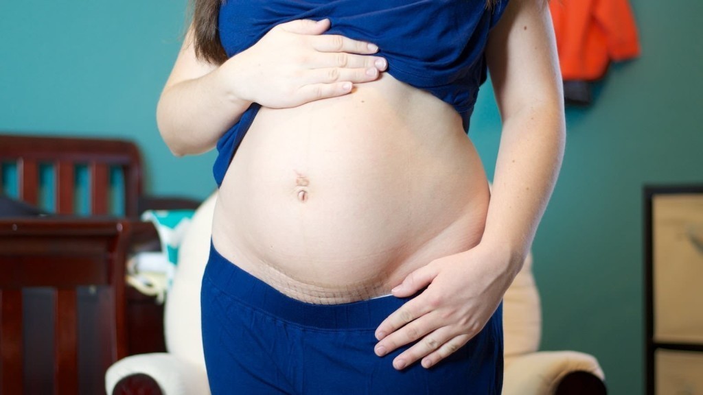 What to do if the belly sagged after childbirth?