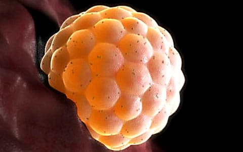 This is a blastocyst